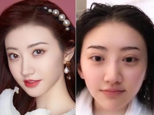 蛙脸婴儿(新生儿蛙抱)插图7