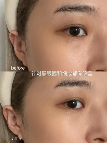 评价最好的眼霜(国内最好用的十大眼霜排名)插图14