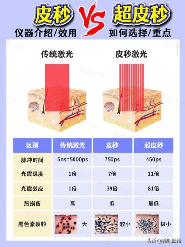 去斑仪器排名前十(洗脸仪器十大排名)插图2