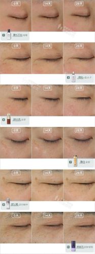 哪种护肤品抗皱好(十大骗人祛皱产品)插图12