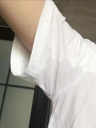 腋臭药推荐排名前十(最好的狐臭药排名)插图4