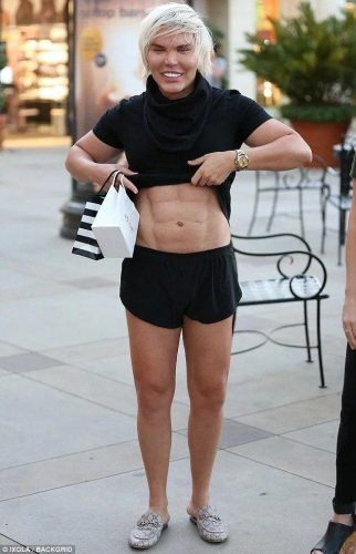 男人整容(男人可以整容吗)插图23
