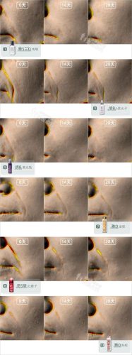 哪种护肤品抗皱好(十大骗人祛皱产品)插图16