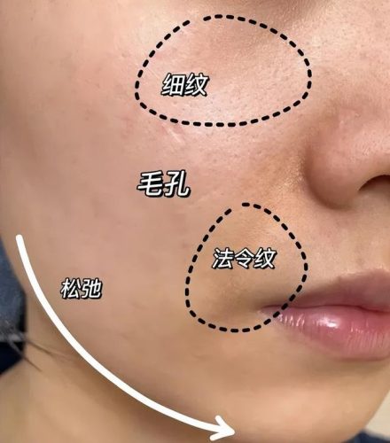 雅诗兰黛护肤套装(雅诗兰黛长期使用的后果)插图1