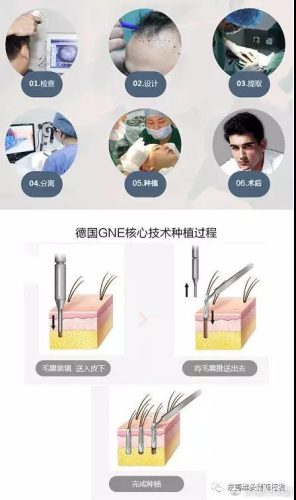 惠州脱发医生排名前十(武汉治疗脱发医生排名)插图5