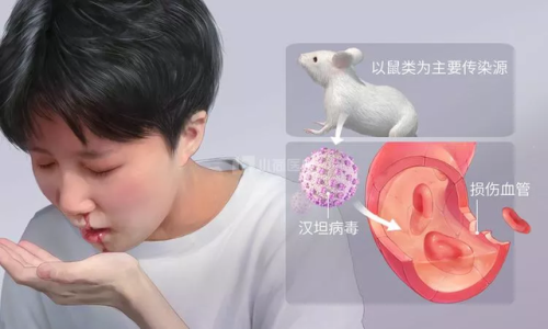西安为什么会爆发出血热(西安长安区是出血热高发区吗)插图5