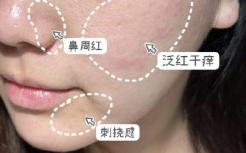 敏感护肤品牌排行榜(最适合亚洲人护肤品牌)