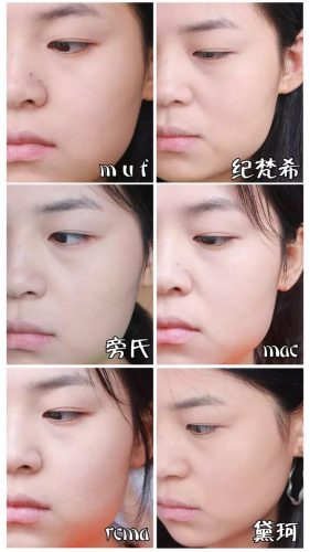痱子粉排行榜(爽身粉对阴囊潮湿有用吗)插图15