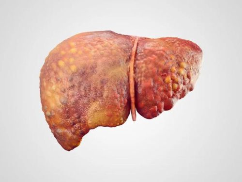 致癌的食物排行榜(一种食物吃了必得癌症)插图9