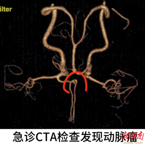 益阳脑瘤医院排名前十(益阳市资阳区脑科医院)插图1