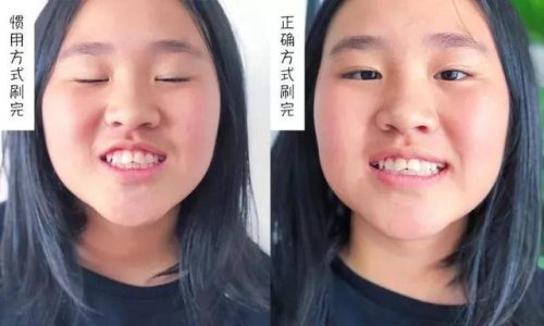 小白兔牙膏排行榜(十大牙膏品牌)插图8