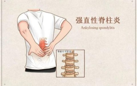 治疗强直医院排行榜(强直医院哪家最好的医院在哪里)