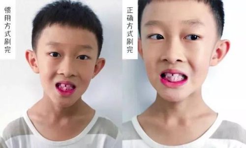 小白兔牙膏排行榜(十大牙膏品牌)插图5