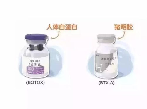 进口瘦脸针牌子排行榜(瘦脸针打什么牌子的好)插图3