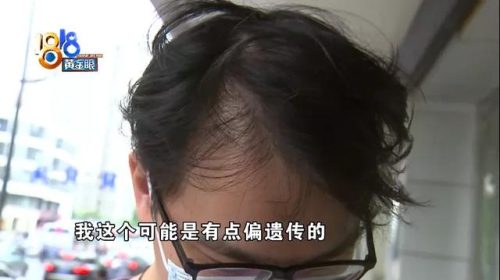 杭州植发医院排行榜(哪里有植发的专业医院)插图