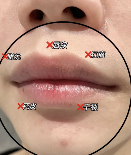 D18面霜排行榜(d18神经酰胺面霜)插图43