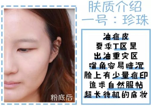 痱子粉排行榜(爽身粉对阴囊潮湿有用吗)插图3
