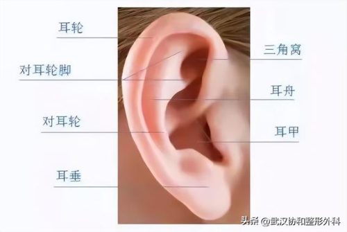 耳朵畸形医院排名前十(宝宝耳朵怎样就算畸形)插图1