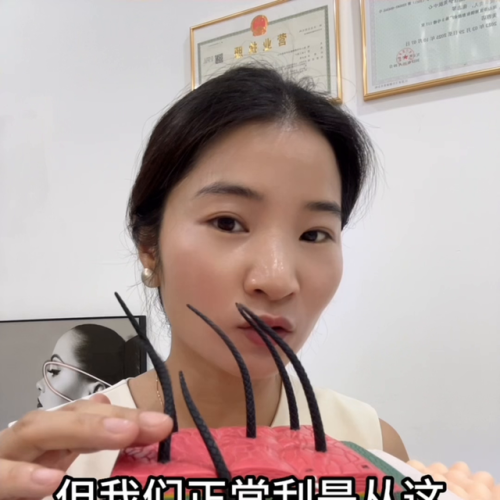 冰点脱毛团购(冰点脱毛后毛囊里黑根怎么去除)插图