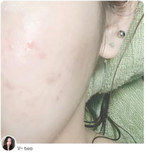 美即精华液排行榜(抗衰精华排行榜10强)插图7