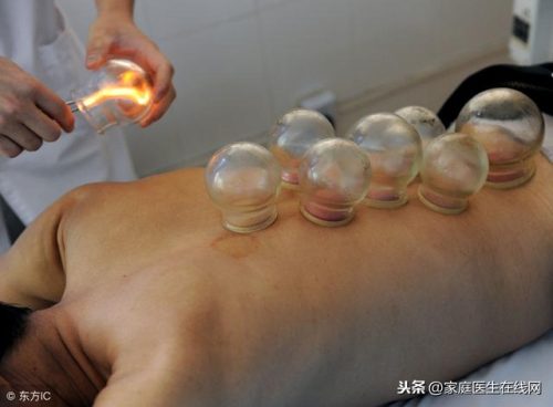 拔火罐拔出水泡(拔罐后出现水泡怎么处理)插图2