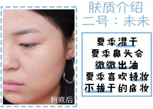 痱子粉排行榜(爽身粉对阴囊潮湿有用吗)插图4