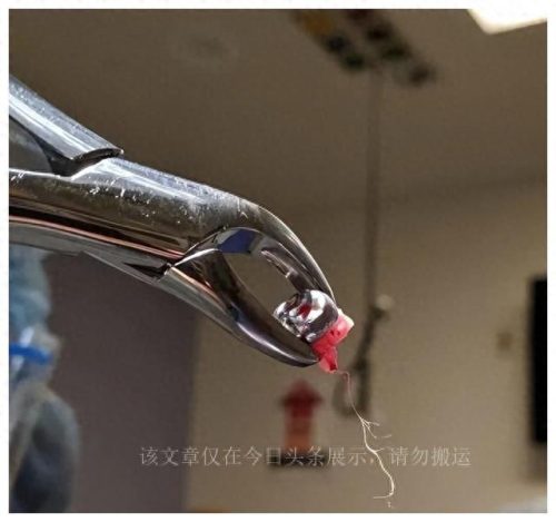 冯哈根斯(大连哈根斯工厂)插图