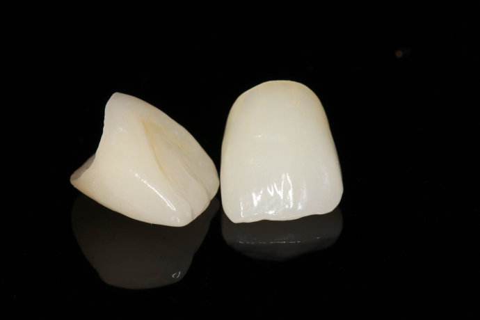 中国牙冠厂家排行榜(全瓷牙冠品牌排行榜前十名)插图