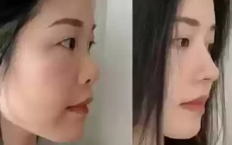 鼻子阵容对比