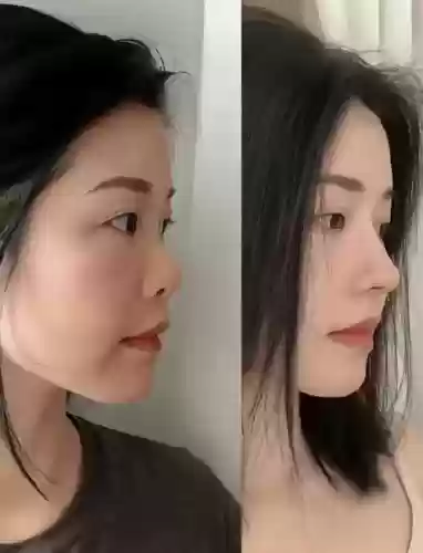 鼻子阵容对比插图