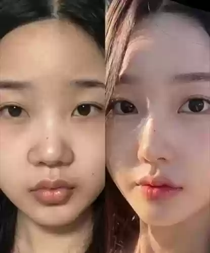 鼻子阵容对比插图1